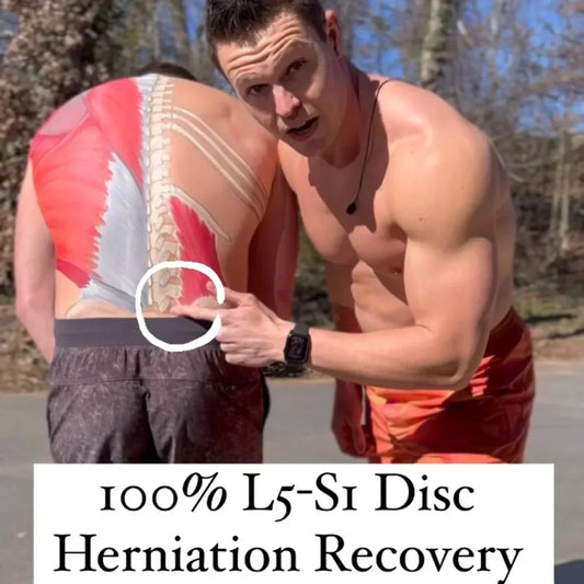 Whealth Co-Founder Cam Overcomes L5S1 Disc Herniation & Sciatica, Makes 100% Recovery Without Surgery