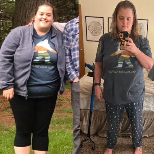 21 MM DISC HERNIATION + BACK SURGERY TRANSFORMATION (and I lost 75 pounds!) - Limitless Program