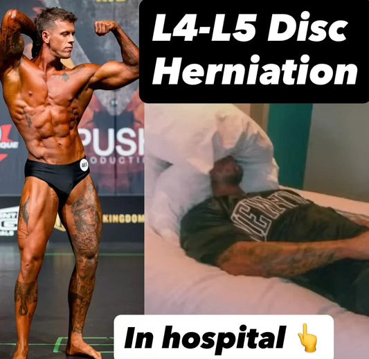 Bodybuilding Injury Put Me In The Hospital… 10 Weeks Later, I’m 95% Pain-Free (SEVERE L4-L5 Disc Herniation + Sciatica)