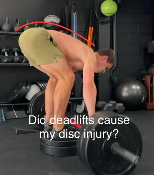 Did Deadlifts Cause my 10 mm L4L5 Herniation and Sciatica?