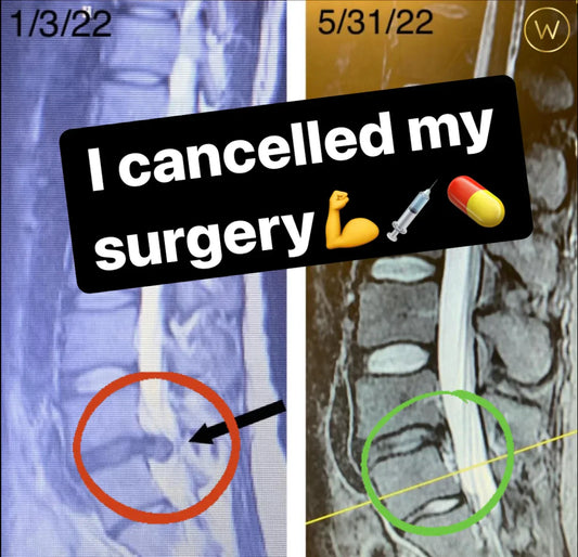 Jana Grujic overcomes a 13.7 mm disc herniation, cancels surgery, and gets off her pain meds