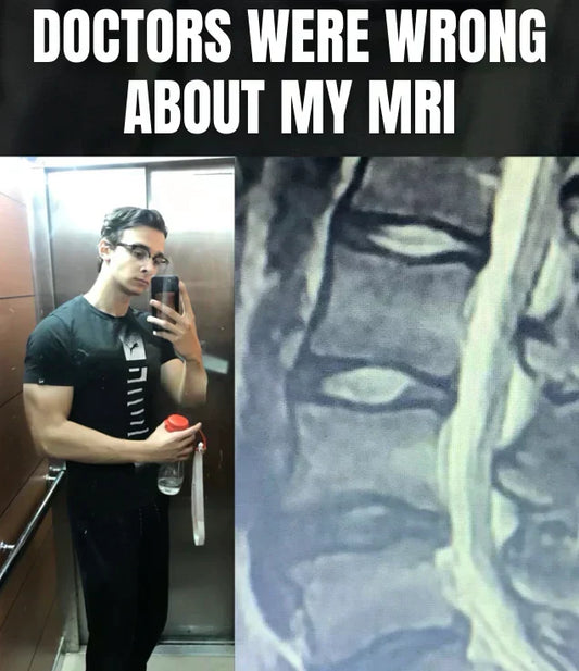 L4-L5 and L5-S1 Disc Degeneration Healed Without Surgery or Pills: 19 Year Old Limitless Member’s Success Transformation