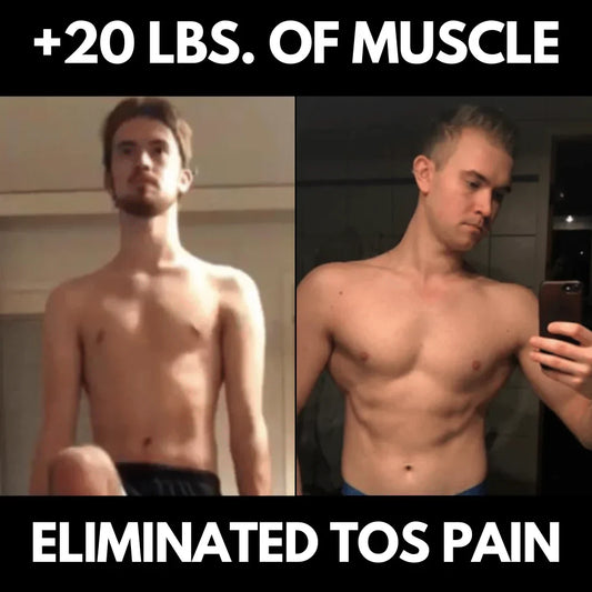 Teppo Eliminates Thoracic Outlet Syndrome (TOS) Nerve Pain & Symptoms, Avoids Rib Surgery, Puts on 20 Lb. Of Lean Mass